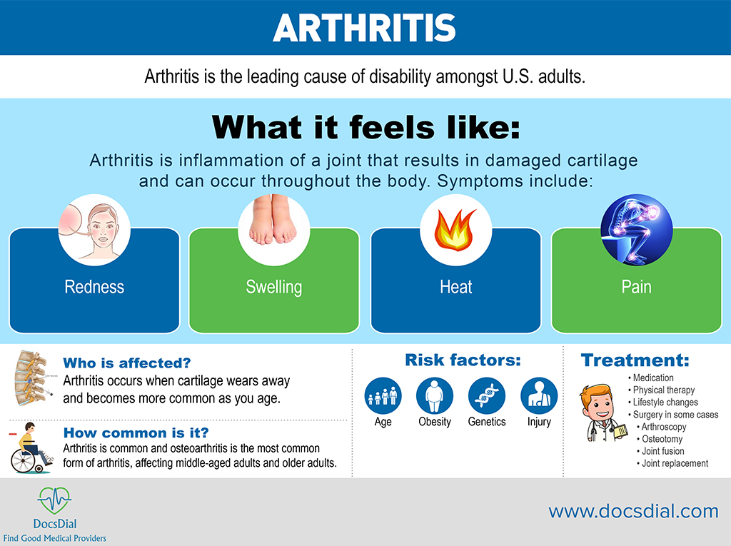 Arthritis Gaurav Abbi