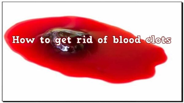 HOW TO GET RID OF BLOOD CLOT NATURALLY Health GadgetsNG