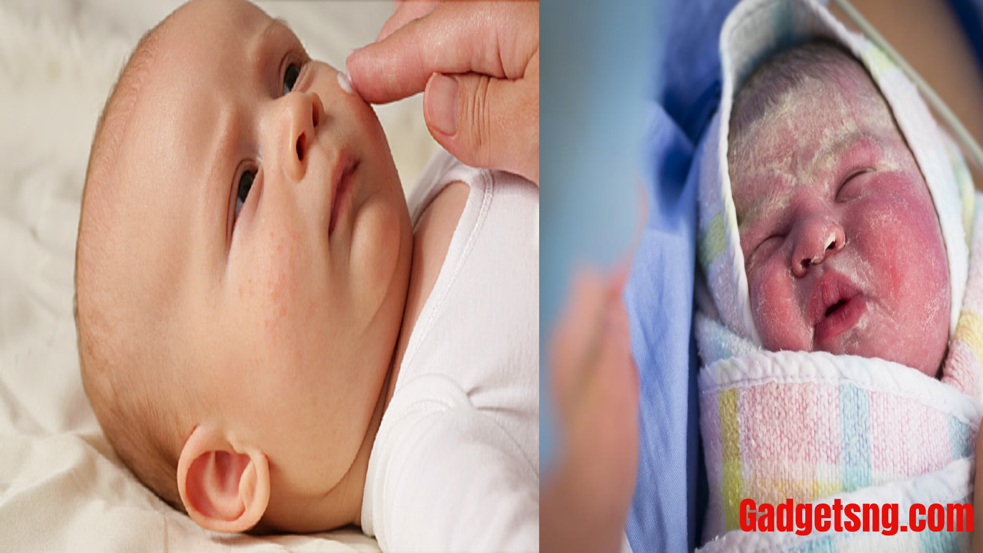 HOME REMEDY FOR NEWBORN'S DRY AND PEELING SKIN Health GadgetsNG