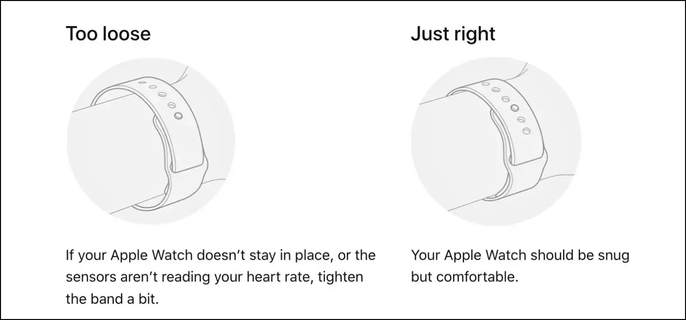 8 Ways to Avoid Rashes or Burns from Your Smartwatch or Fitness Band