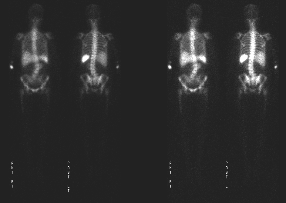 MIR Teaching file case iw016