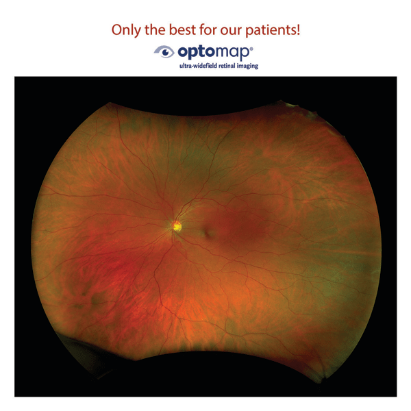 Optomap UltraWidefield Retinal Imaging Gardiner Opticians