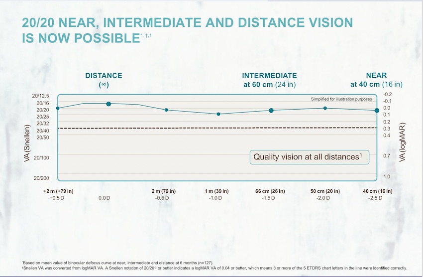 PanOptix Lens (IOL) Gary Foster MD