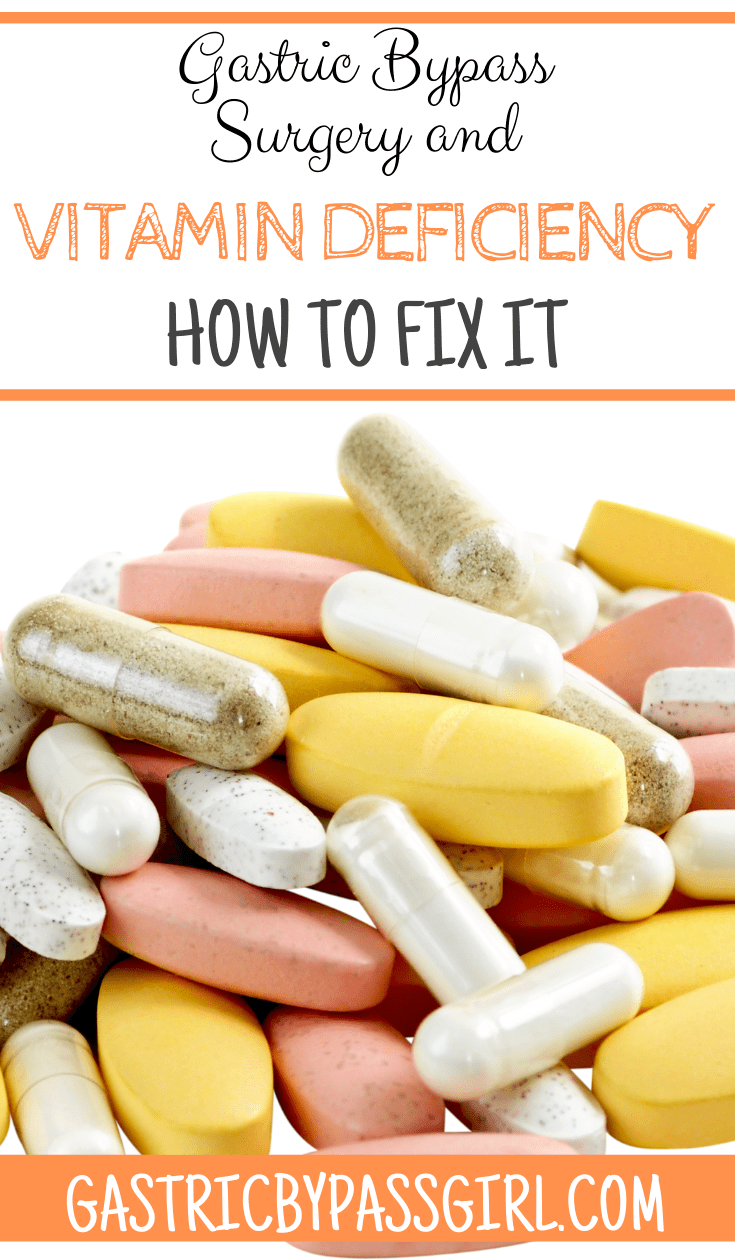 Gastric Bypass and Vitamin Deficiency What to Expect Gastric Bypass Gal