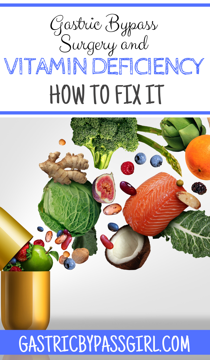 Gastric Bypass and Vitamin Deficiency What to Expect Gastric Bypass Gal