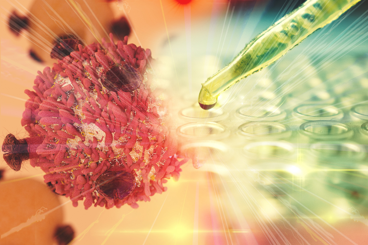 Gastric Cancer Foundation GCFAGA Grant Recipient ElZaatari Charts