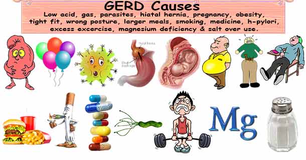 GERD Causes Gastrodigestivesystem