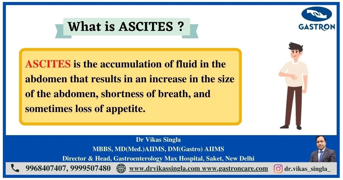 Ascites Causes, Symptoms, Treatment & Preventions Gastron