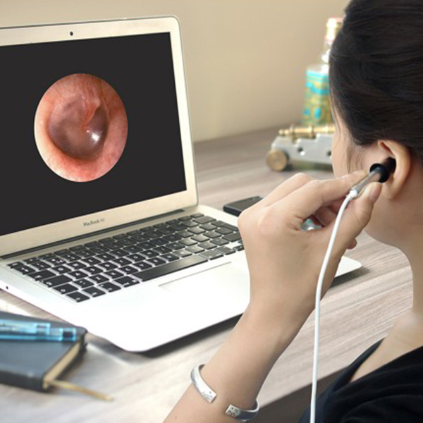 Buy Teslong NTE100 Digital Otoscope Online on GEECR