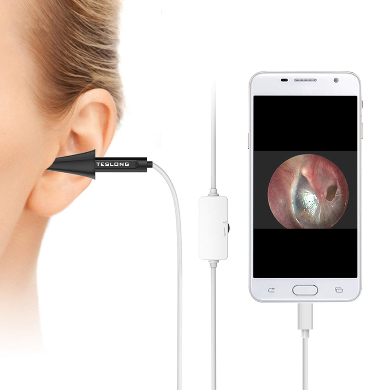 Buy Teslong NTE100 Digital Otoscope Online on GEECR