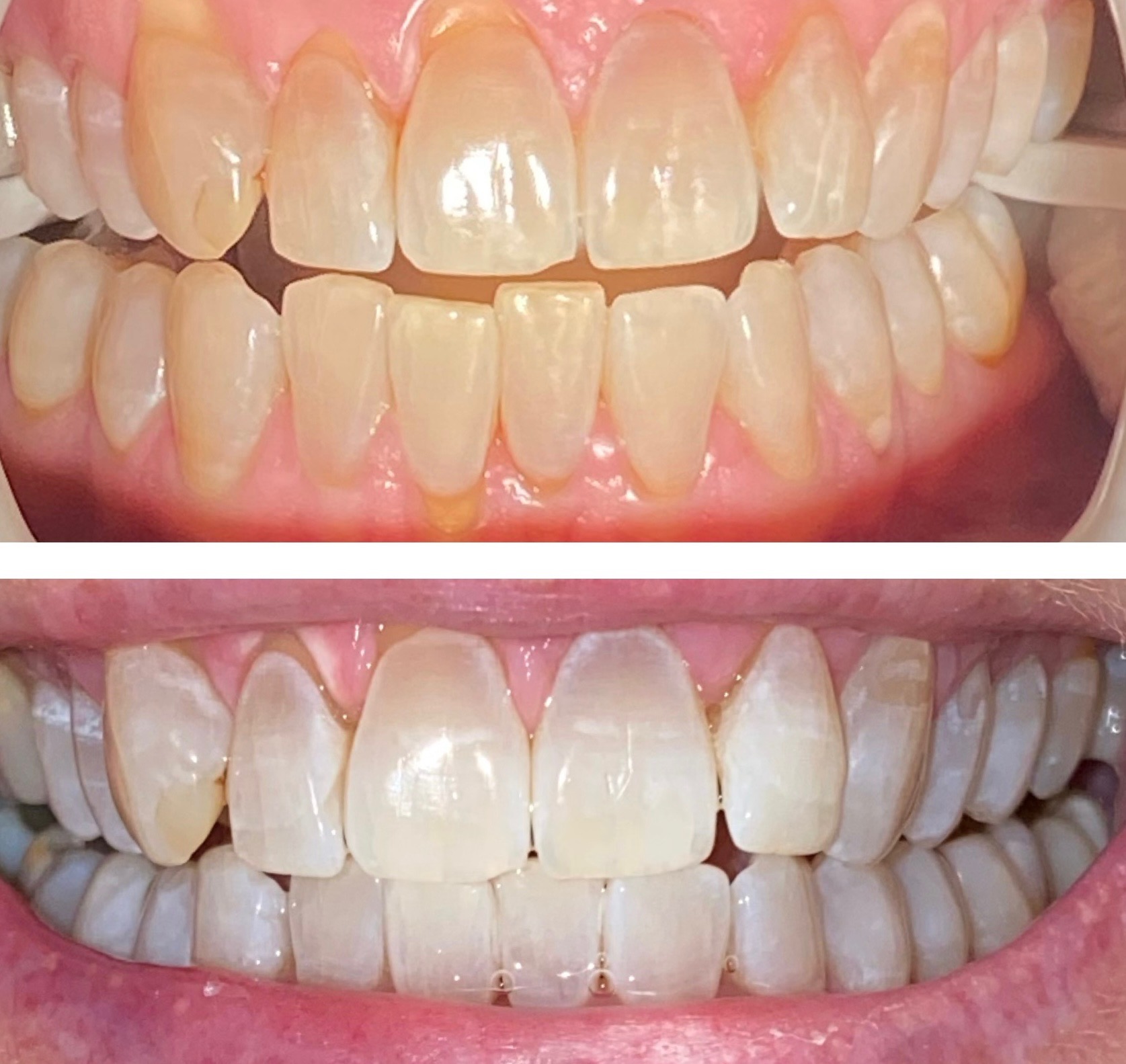 Dentist Columbia SC Gee Family and Cosmetic Dentistry