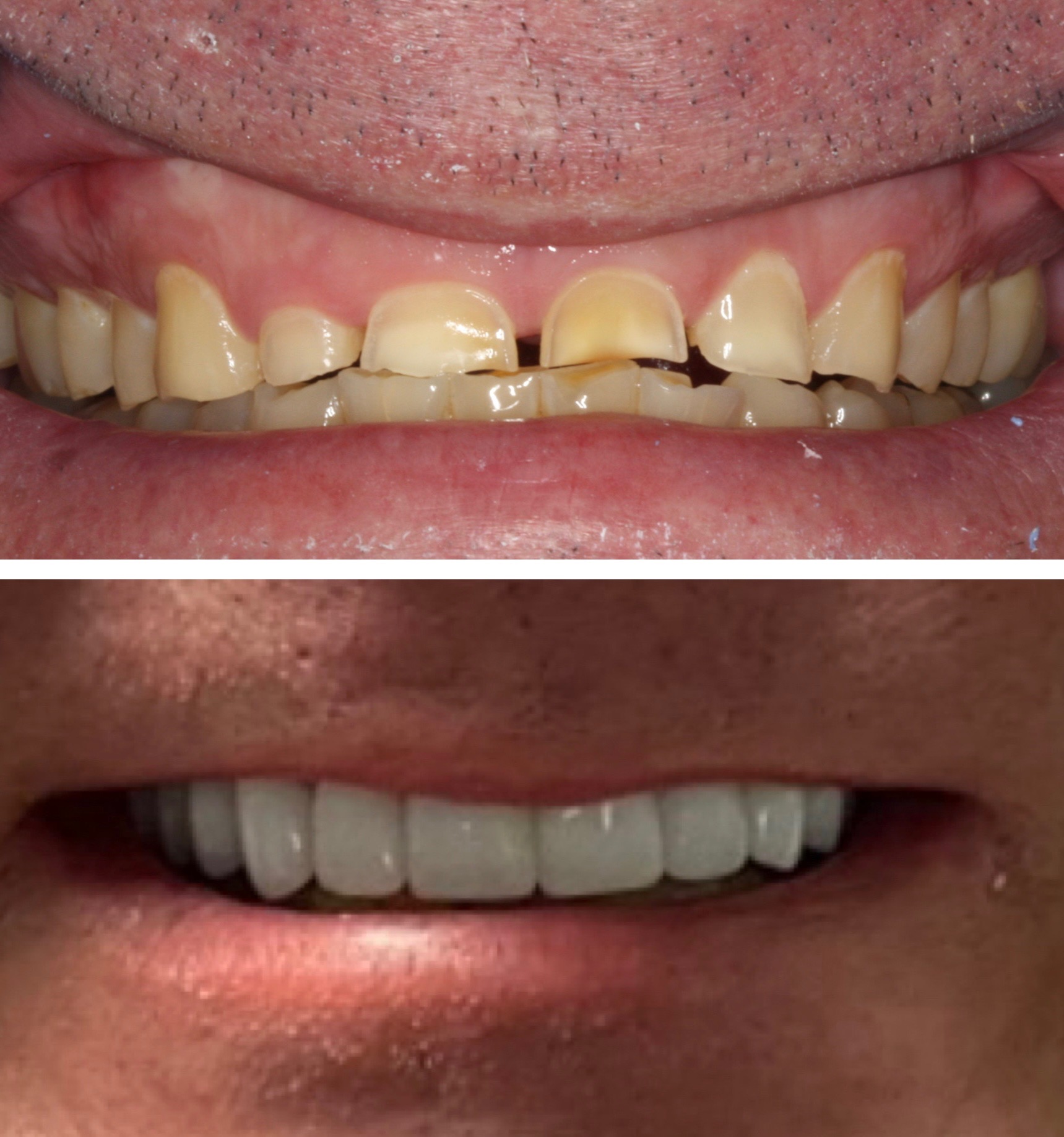 Dentist Columbia SC Gee Family and Cosmetic Dentistry