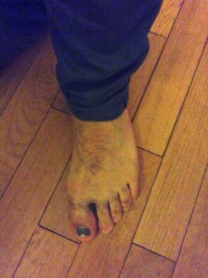 Le top des pieds les plus moches du monde. Vous allez cracher votre repas