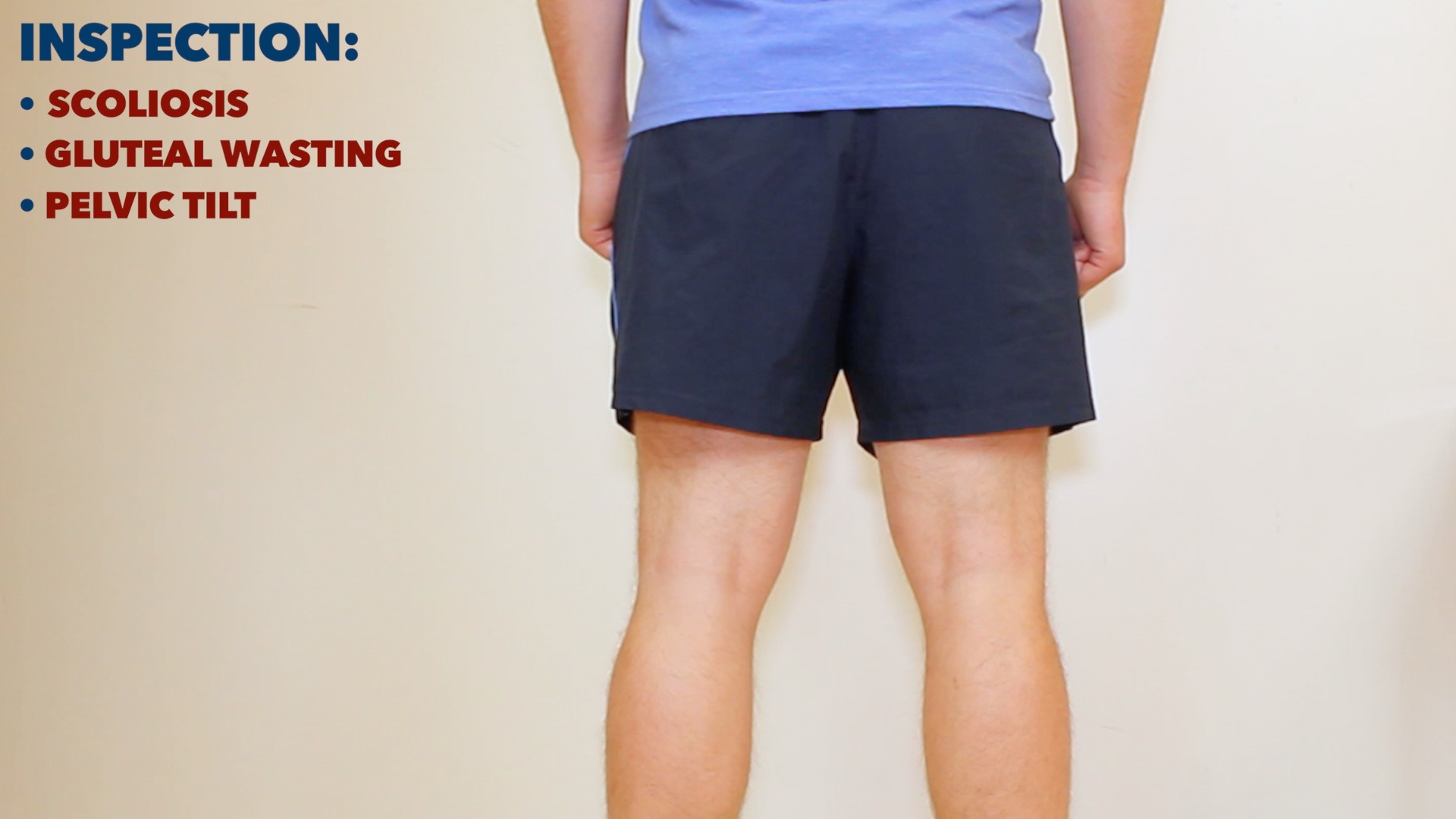 Hip examination OSCE Guide Geeky Medics