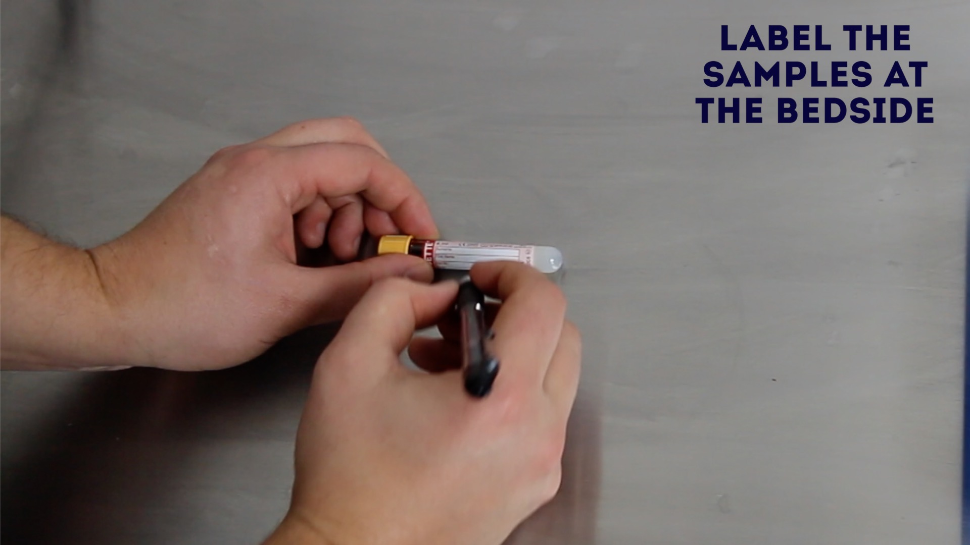 Venepuncture Procedure OSCE How to Take Blood Geeky Medics