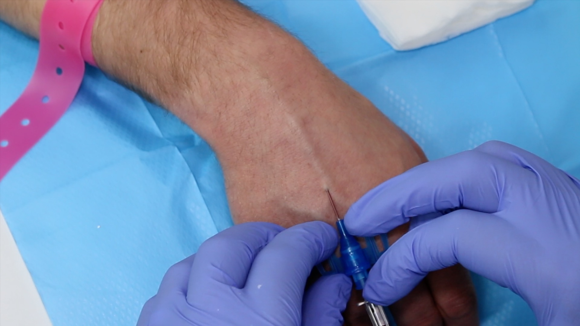 Intravenous cannulation (IV) OSCE Guide Geeky Medics