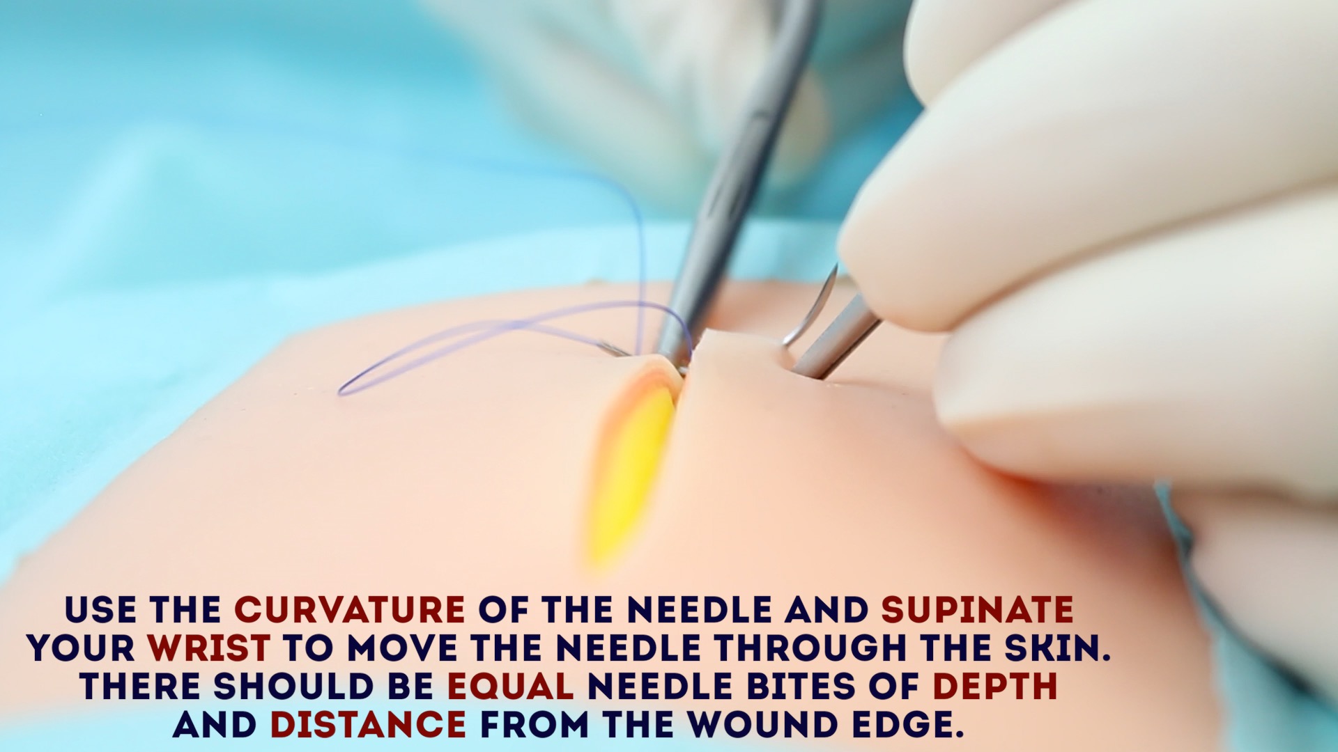 Simple Interrupted Suture OSCE guide Wound Suturing Geeky Medics