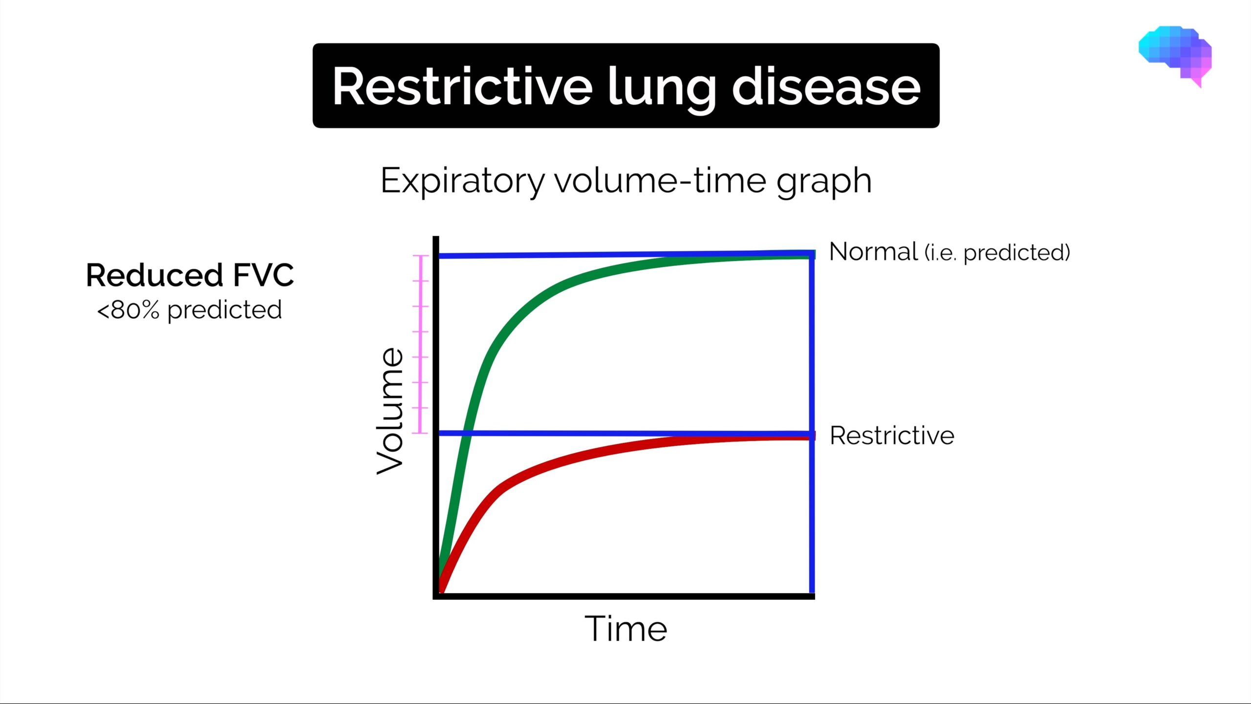 Spirometry Interpretation Obstructive vs Restrictive Geeky Medics