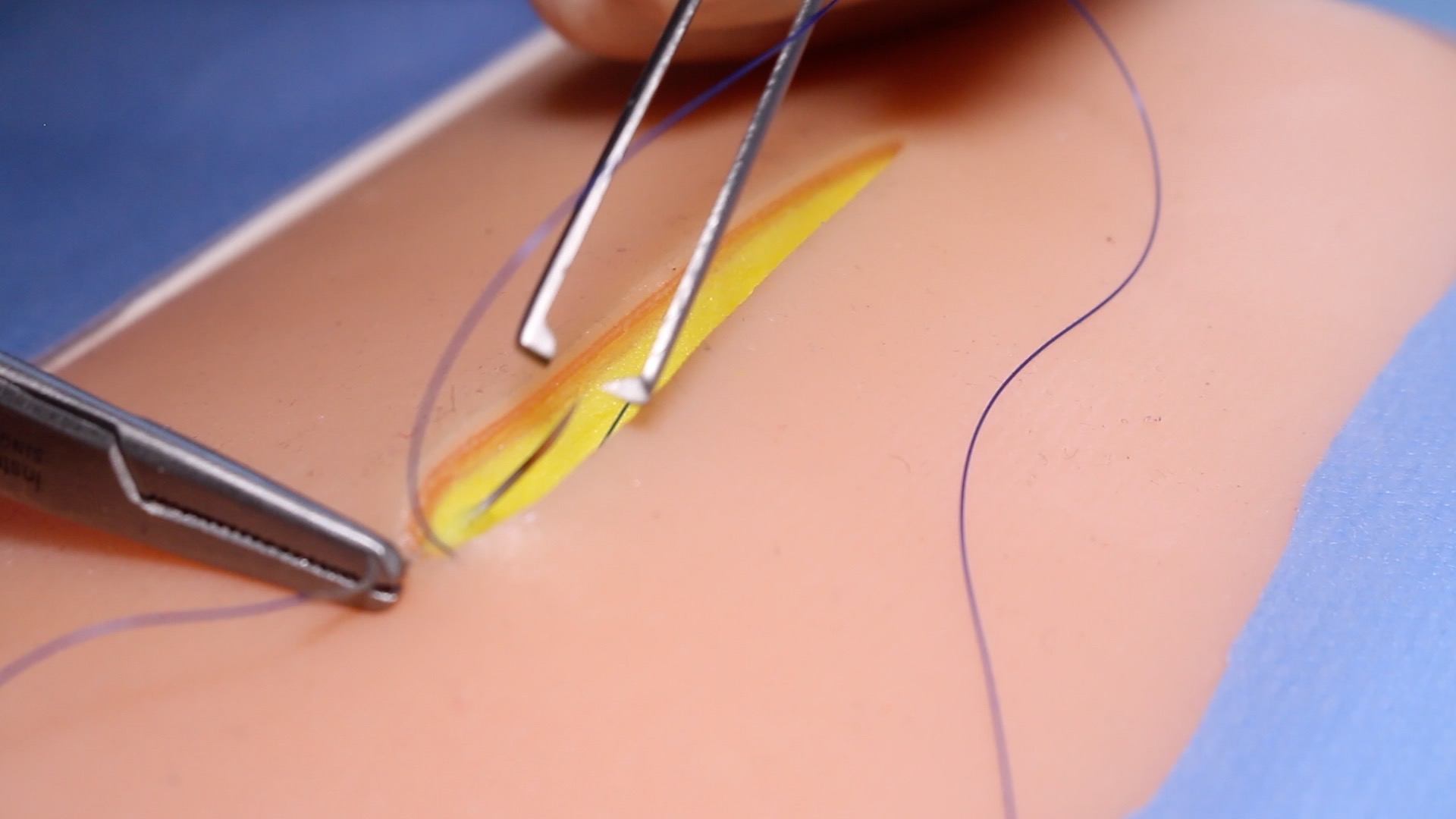 Subcuticular Suture OSCE guide Surgical Skills Geeky Medics