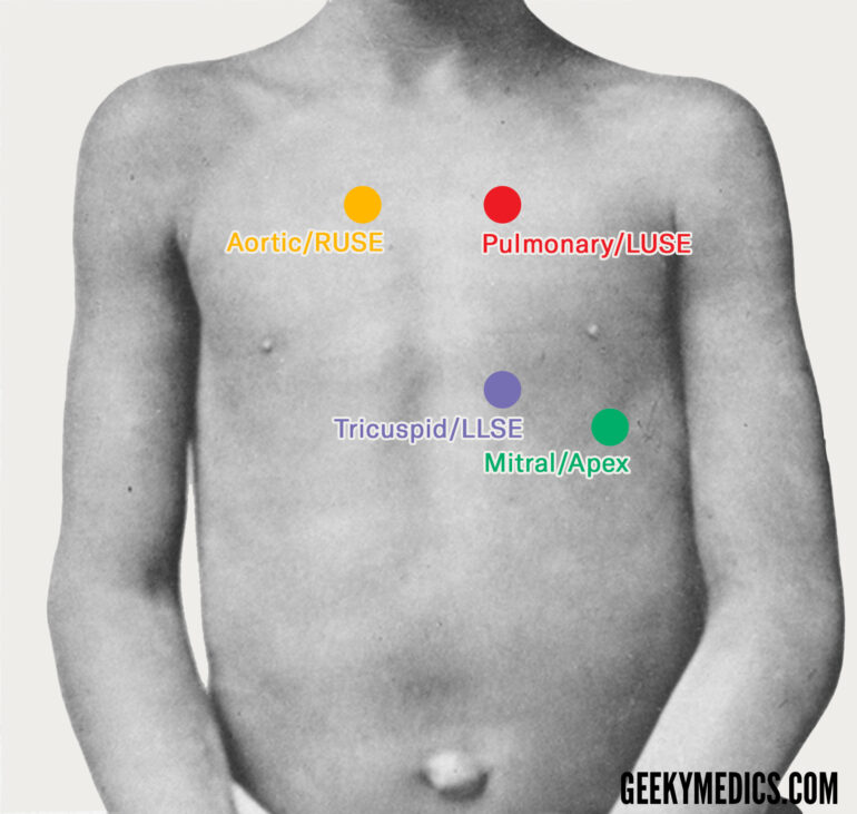 Paediatric Cardiovascular Examination OSCE Guide Geeky Medics
