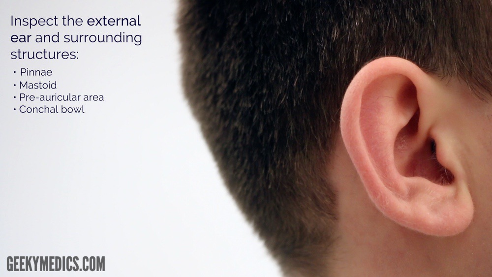 Cone Of Light Left Ear