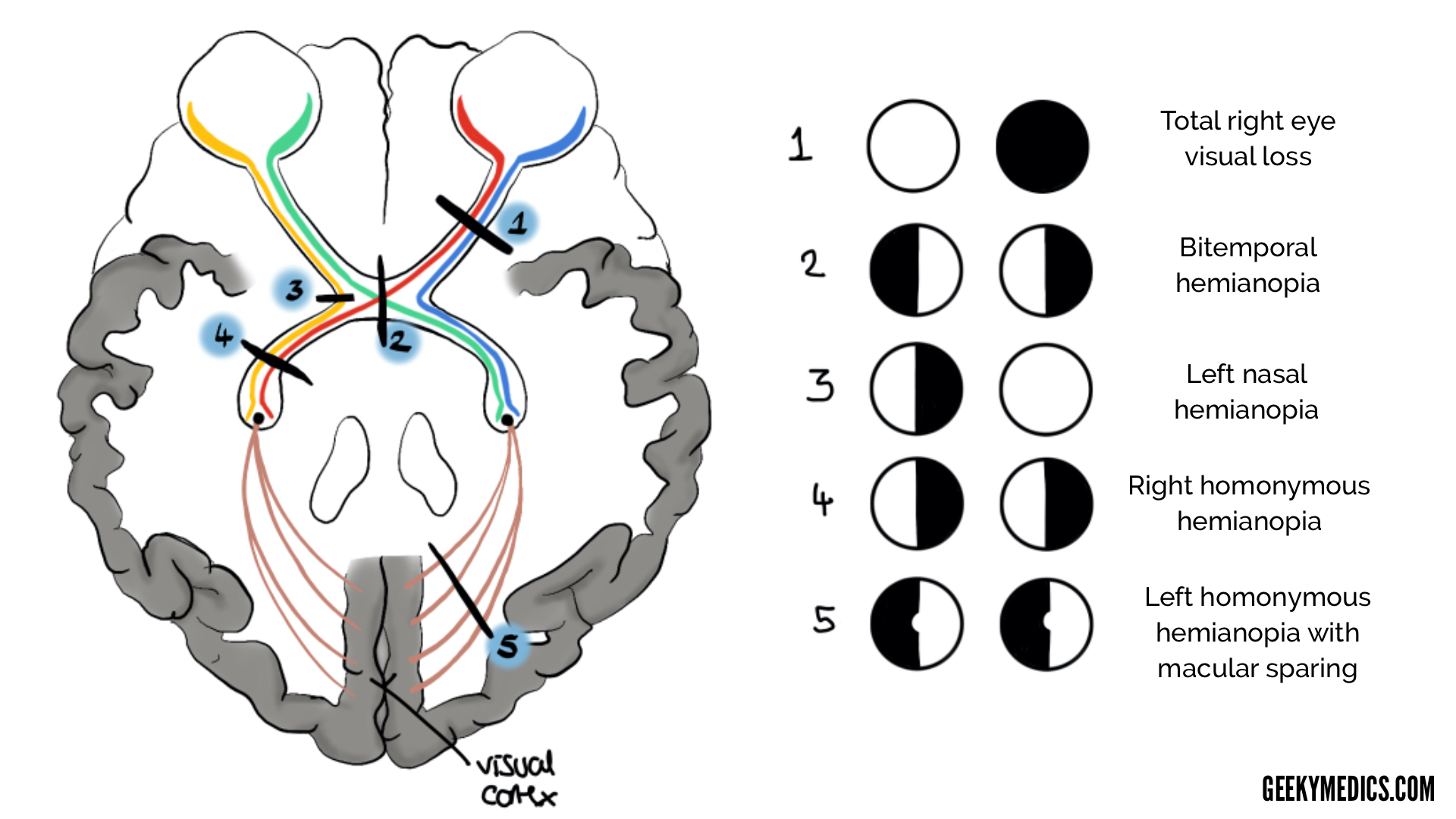 Cranial Nerve Examination OSCE Guide Geeky Medics