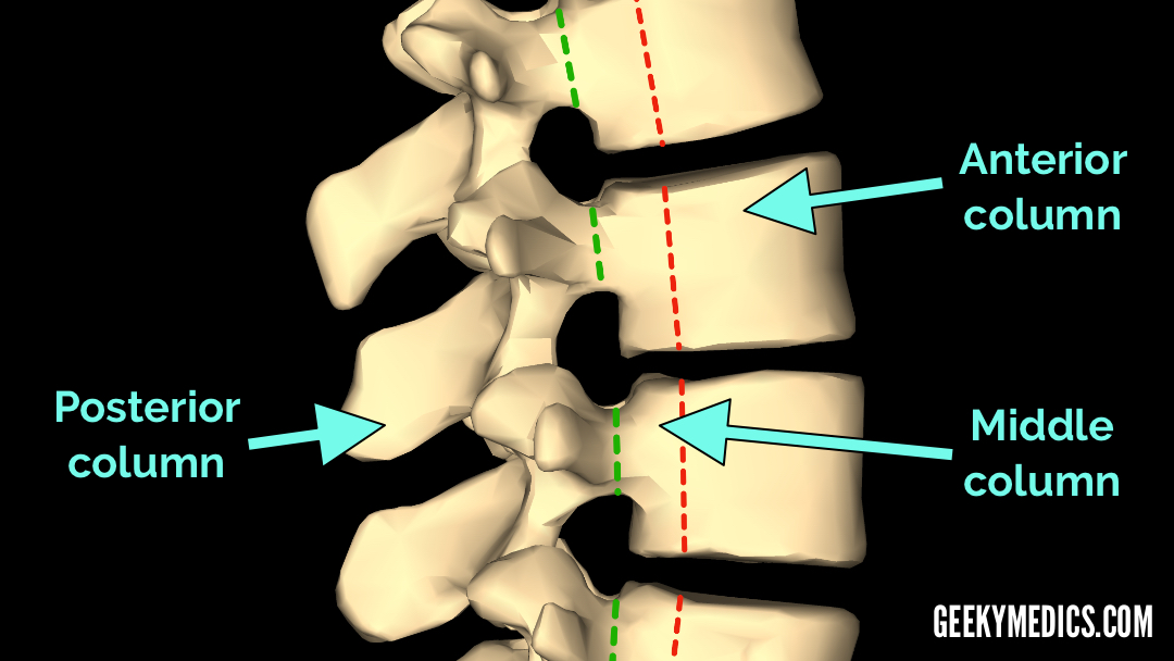 Lumbar Xray Interpretation OSCE Guide Radiology Geeky Medics