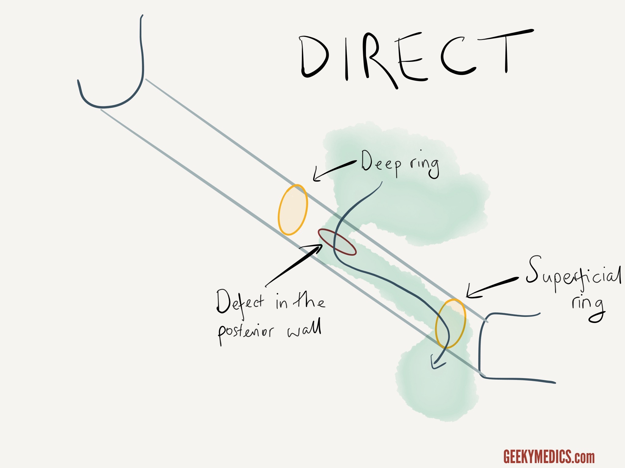 The Inguinal Canal | Geeky Medics