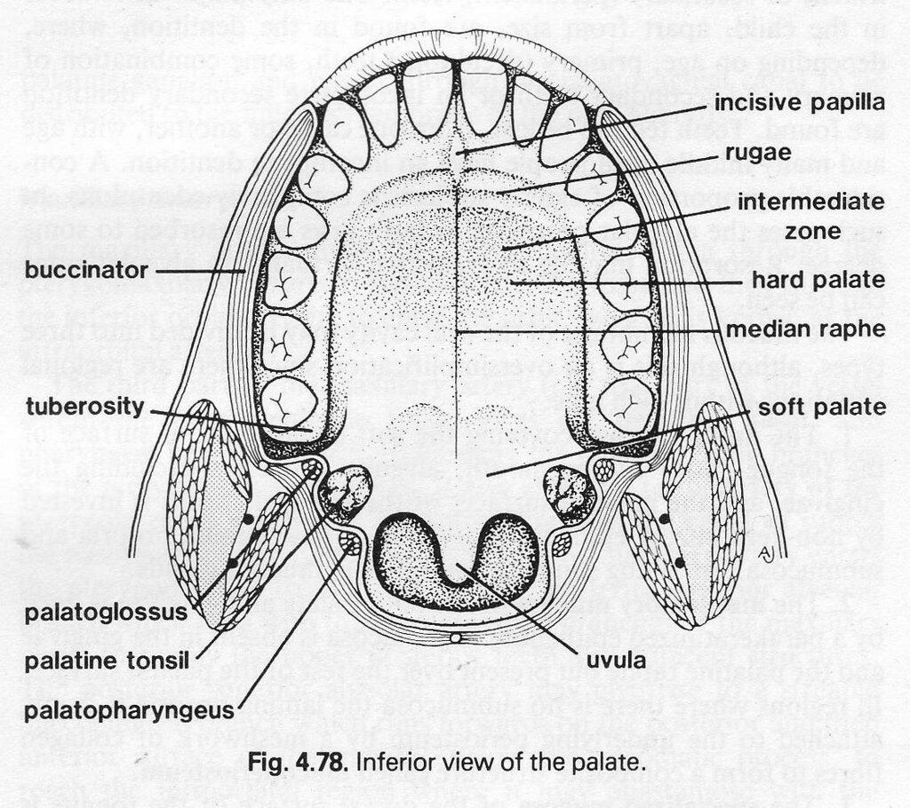 Cleft Lip and Palate Surgical Repair Geeky Medics