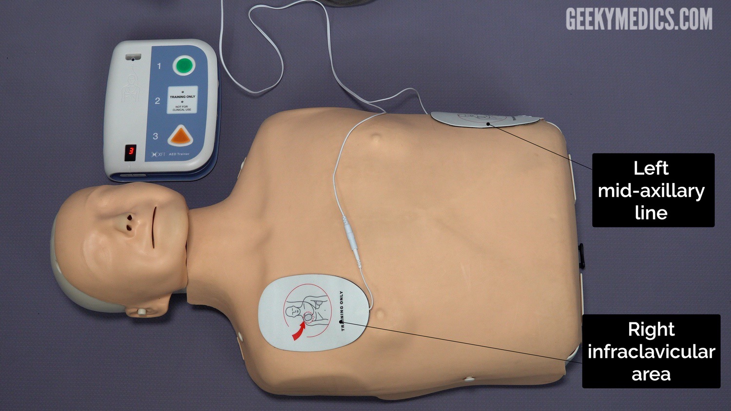 Using an Automated External Defibrillator (AED) OSCE Guide Geeky Medics