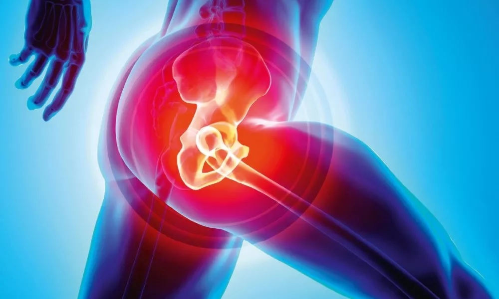 Hip Replacement Recovery Time And Its Cost Gem Five