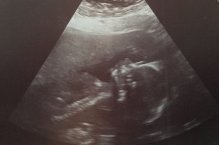 AnatomyUltrasoundProfile