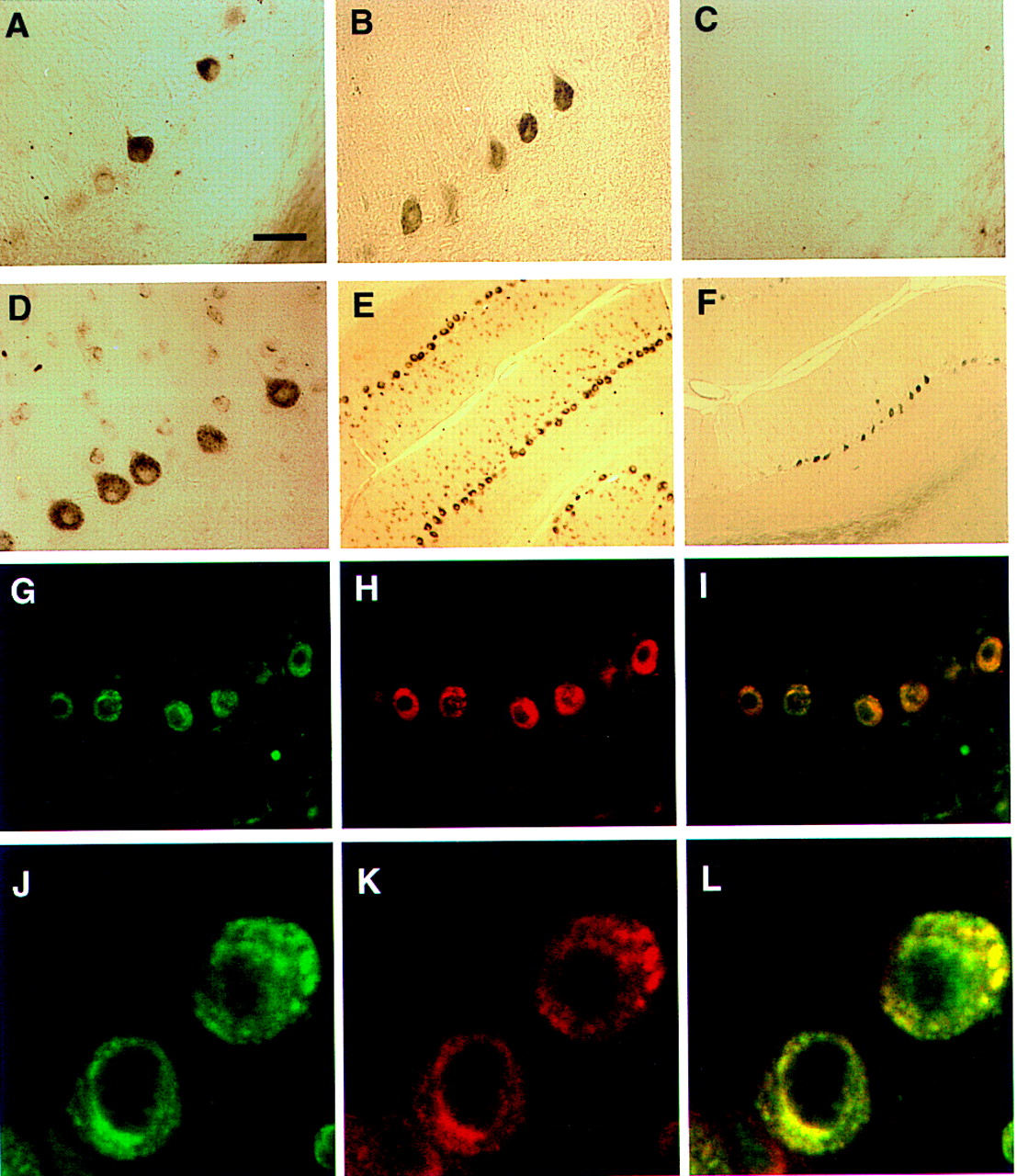 The cytoplasmic Purkinje onconeural antigen cdr2 downregulates cMyc