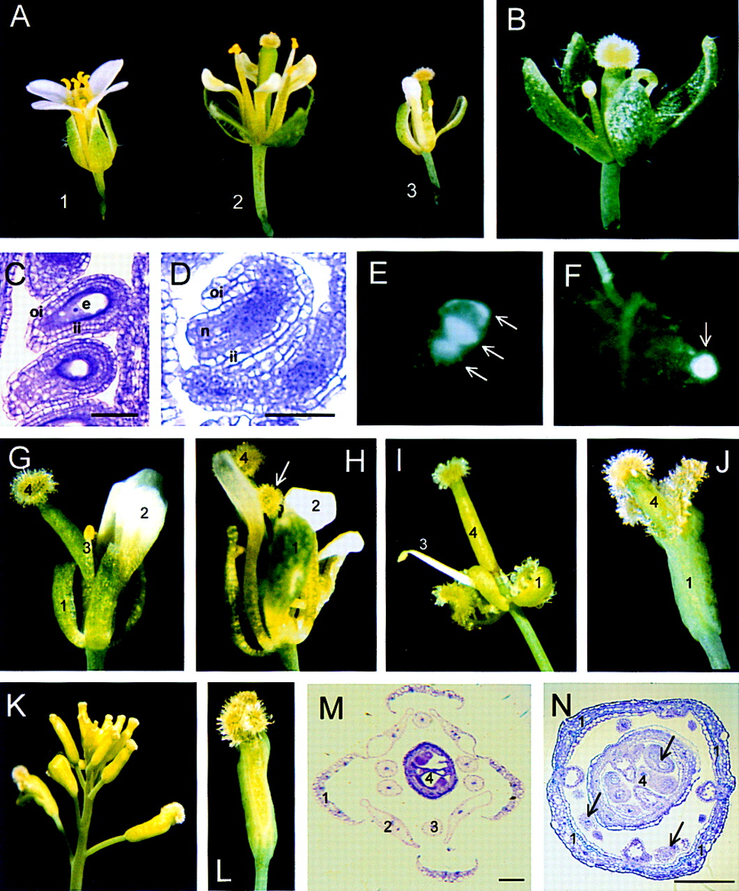 Arabidopsis STERILE APETALA, a multifunctional gene regulating