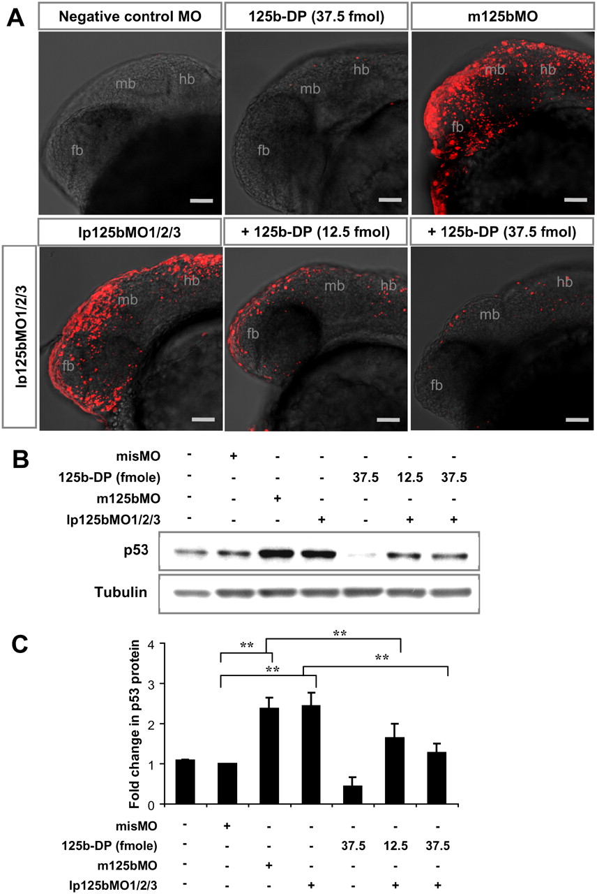 MicroRNA125b is a novel negative regulator of p53