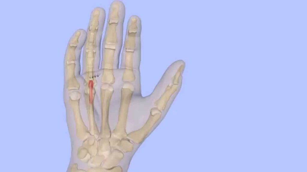 Trigger Finger Release Genesis Orthopedic & Sport Medicine