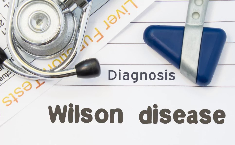 Life with Wilson's Disease How a LowCopper Diet and Therapy Help