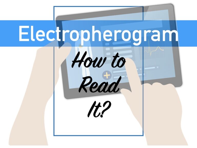 What is Electropherogram? How to Read it? Education