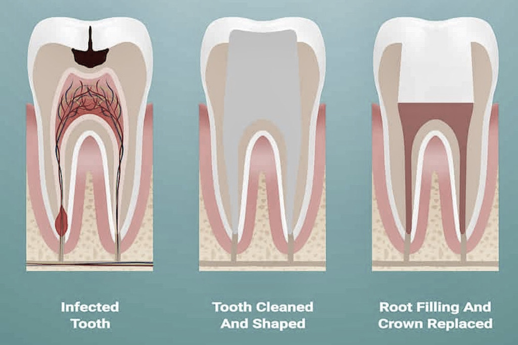 Treatment Gentle DENTAL CARE of Droitwich