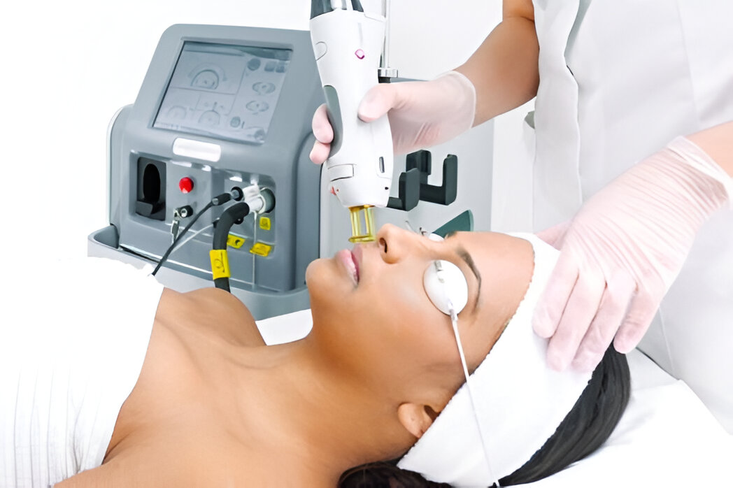 About Laser Hair Removal Gentle Touch Lasers