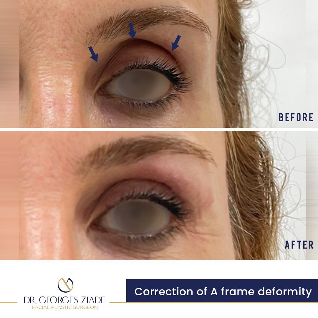 Cosmetic procedures Dr. Ziade Clinics