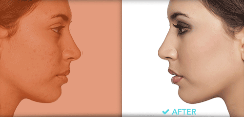 Celebrate with us! Plastic Surgery