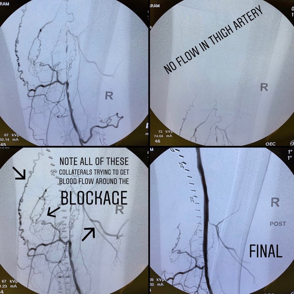 Vascular & Interventional Cutting Edge Medicine Close to Home