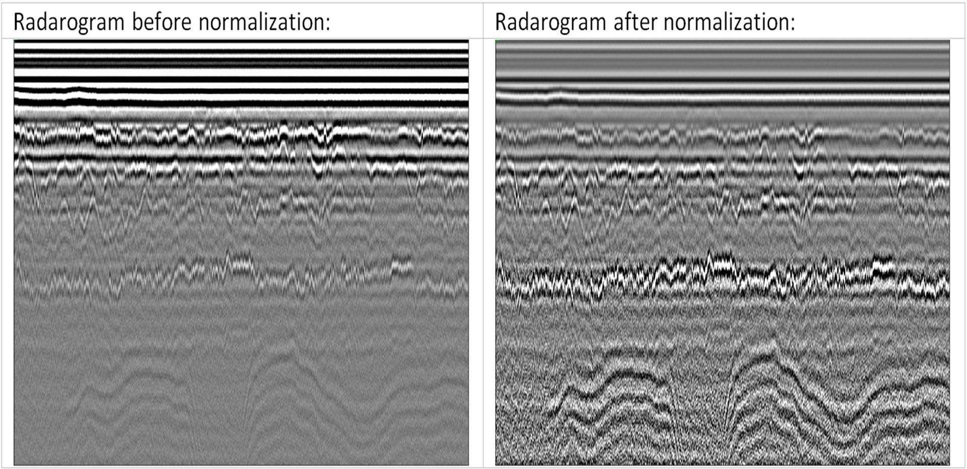 Filtration and amplification of radarograms