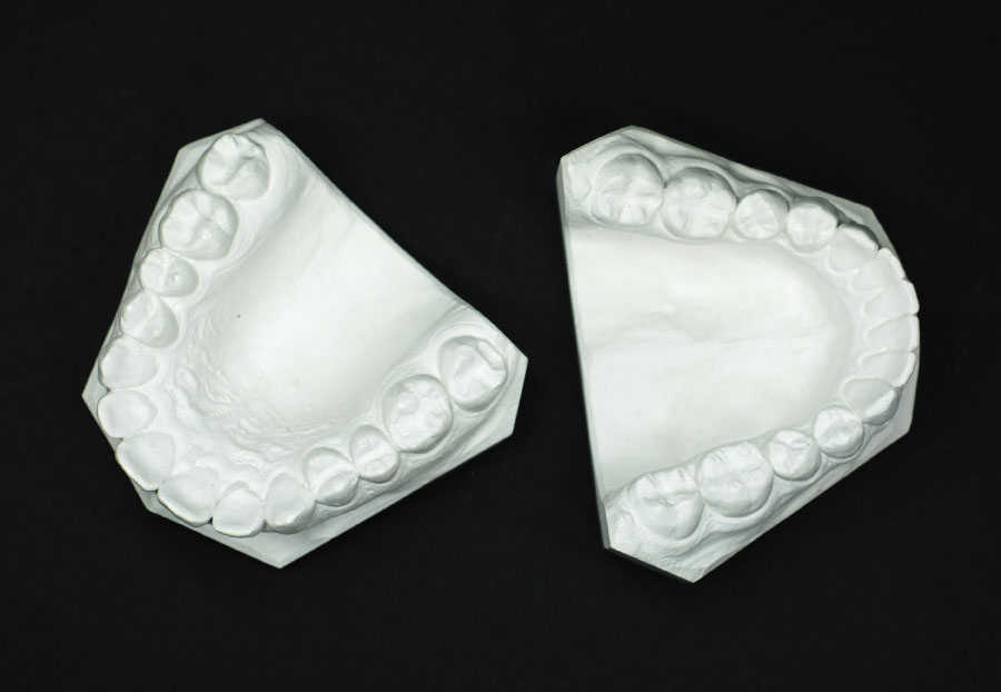 Study Models German Zahn Dental Lab