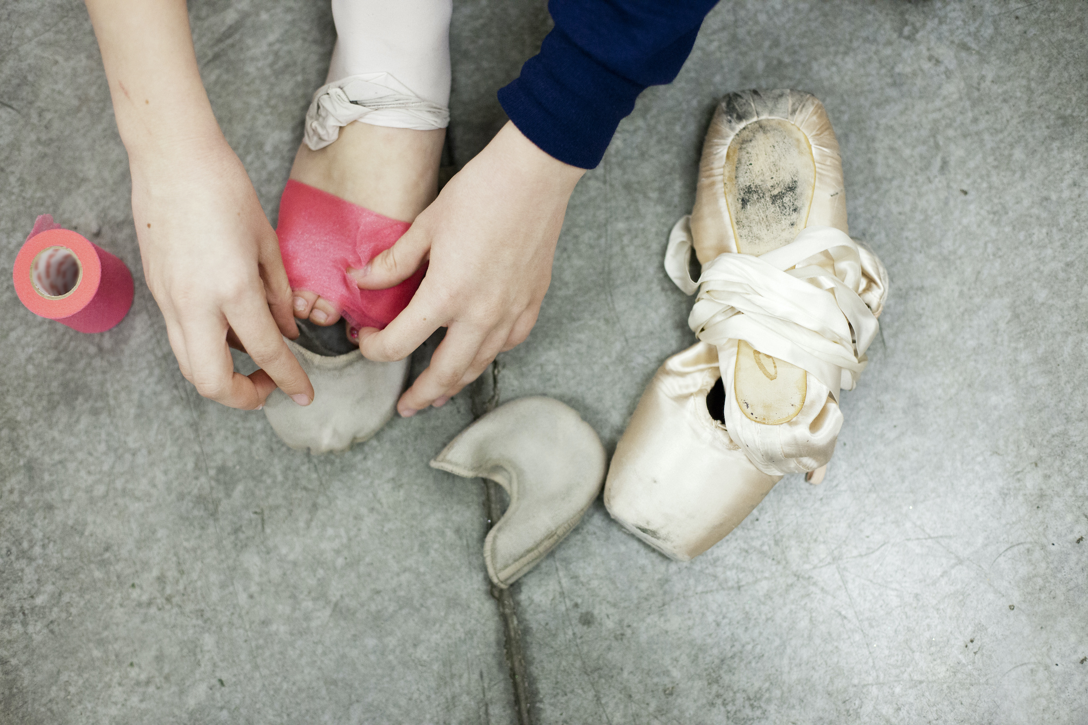 How to Deal with Bunions as a Ballet Dancer