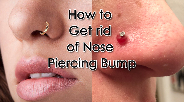 How to Get Rid of Nose Piercing Bump Nose Piercing