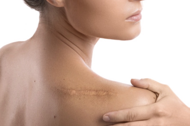 Scar Removal Laser Loft LLC at Heber Springs