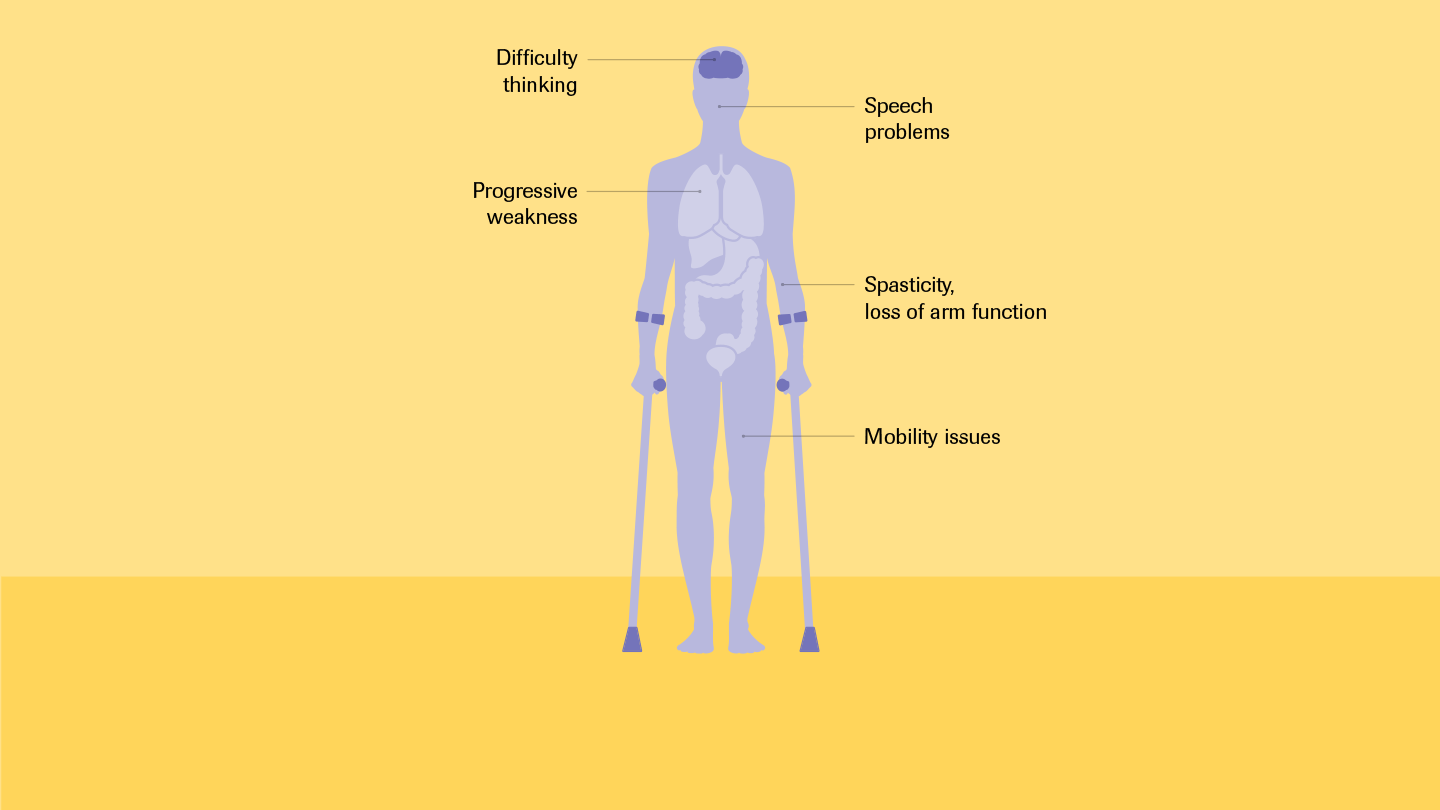 Understanding Multiple Sclerosis Get on with Life