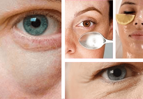 Simpele Tips Tegen Wallen Onder De Ogen - Gezonder Leven